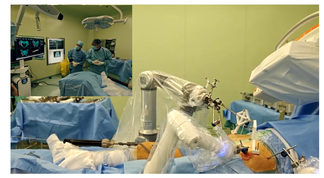 黑龙江省首例!哈医大二院用机器人完成复杂骨盆骨折手术
