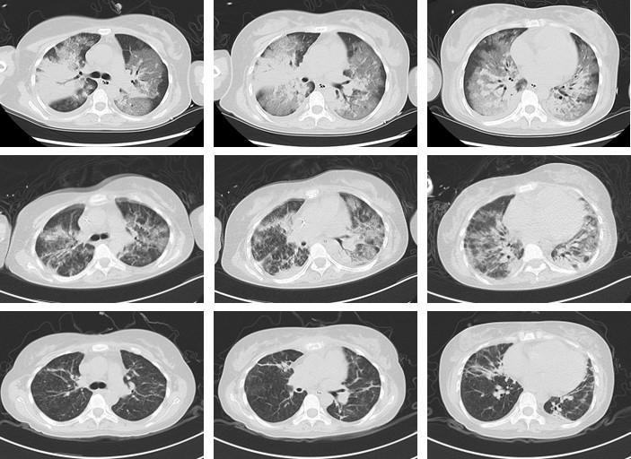 0147853225d66172310013817510963210.jpg?auth=2b0227b374893566205353258956a5c7