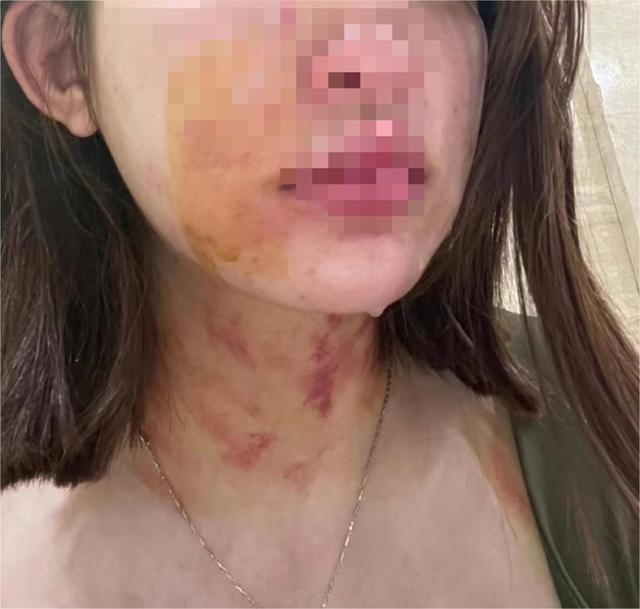 女子牵狗进电梯遭一对夫妇扯衣致胸部裸露妇联回应
