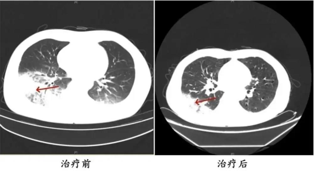 乐鱼体育官方网站近期高发！当心吹空调也能吹出“致命”病(图1)