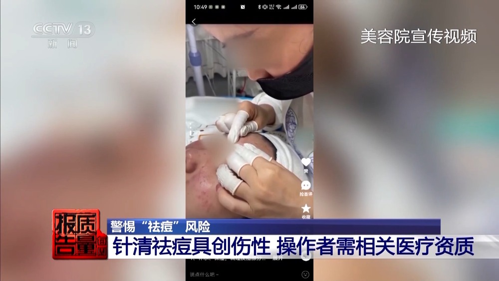 每周质量报告丨“针清”后痘痘不减反增 这些祛痘法操作不当可能会“烂脸”_央广网