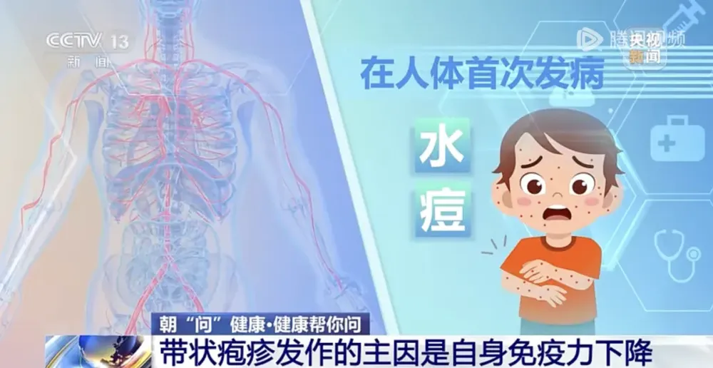 拆快递不洗手小心得带状疱疹